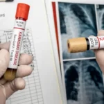penyakit kawasaki disease adalah